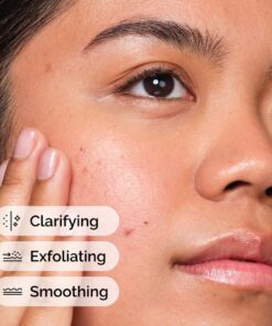 Alternative view of The Ordinary - Solution à L'acide Salicylique 2%